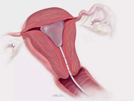 中信三代试管医院怎么样