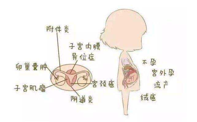 柳州三代试管生子费用高吗